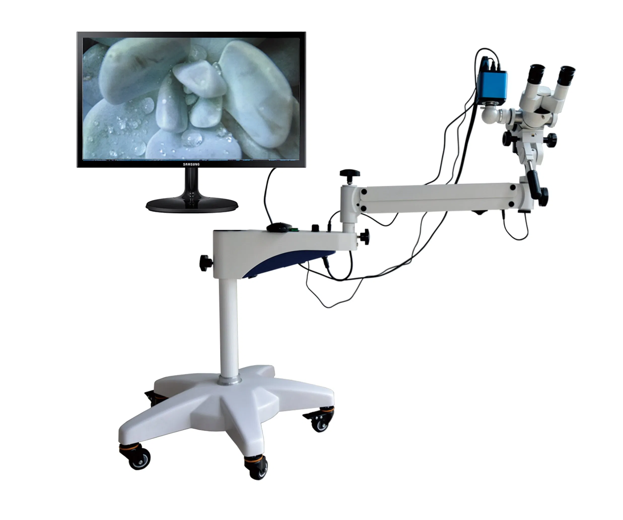 Advanced Digital Colposcope for Comprehensive Women's Health Care