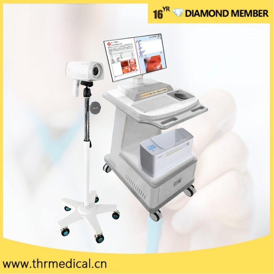 Hot Sale Medical Portable Camera Endoscope Digital Video Colposcope for Vagina