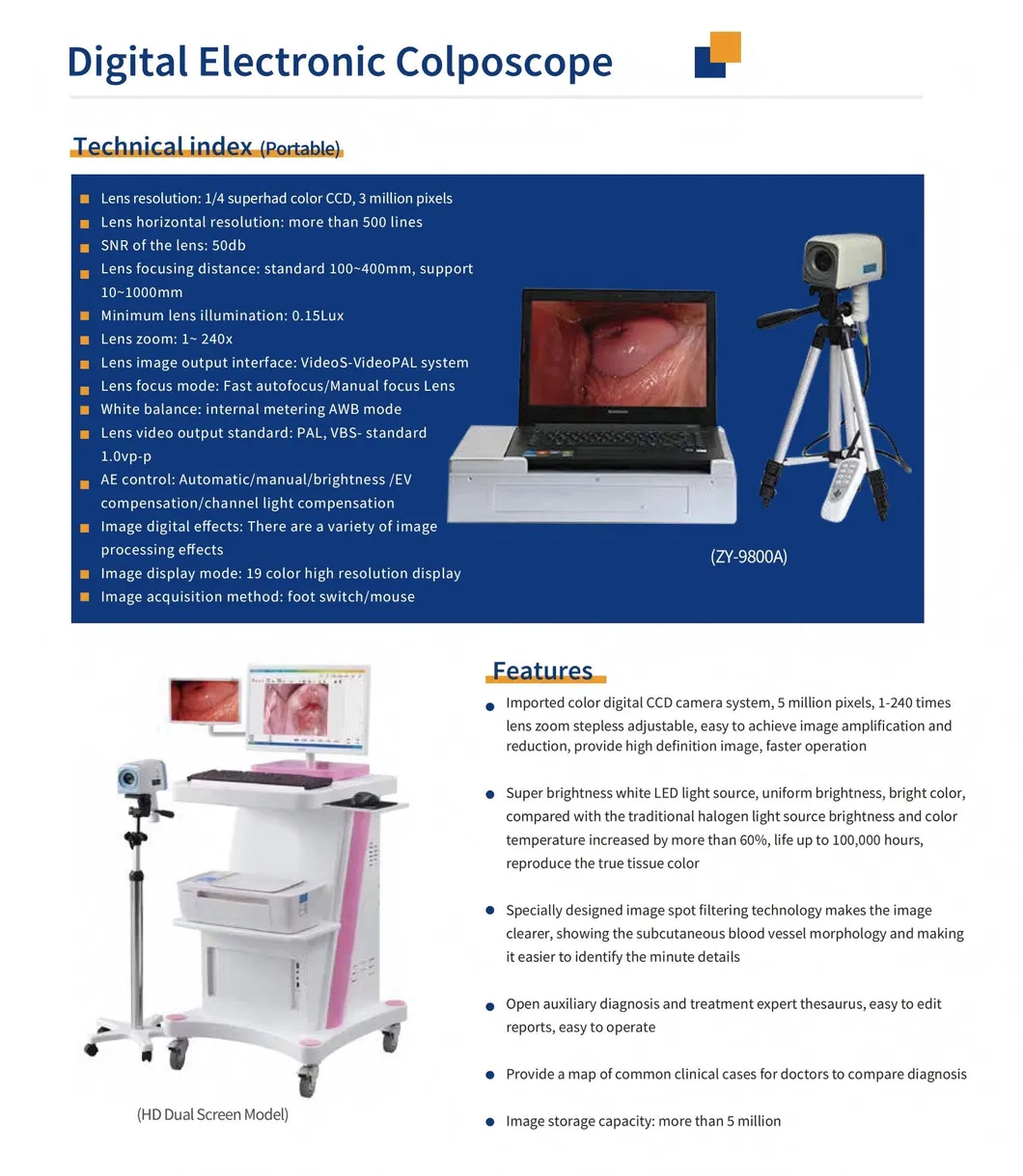 Digital Colposcope 1