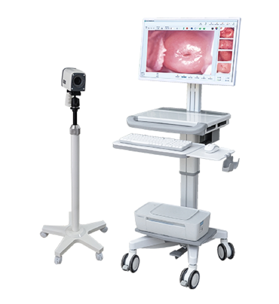 Ouman Full HD Portable Video Colposcope Vaginal Colposcopy Medical Device