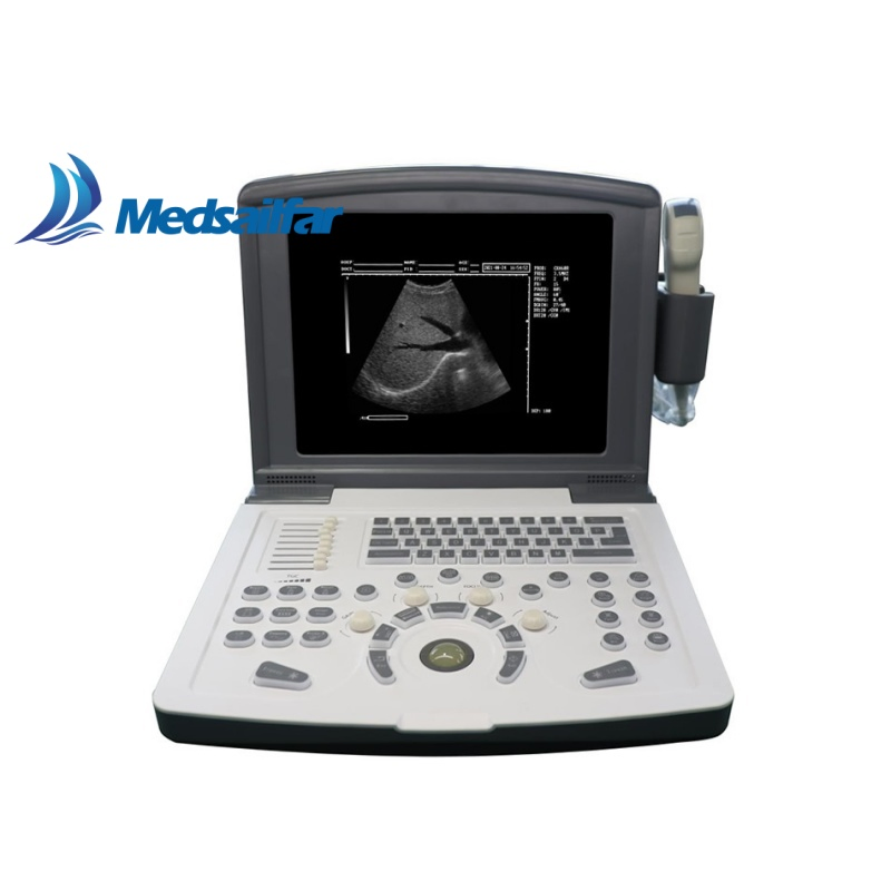 Comprehensive Patient Care Ecografo Detecting B/W Color Doppler Ultrasound Equipment Device
