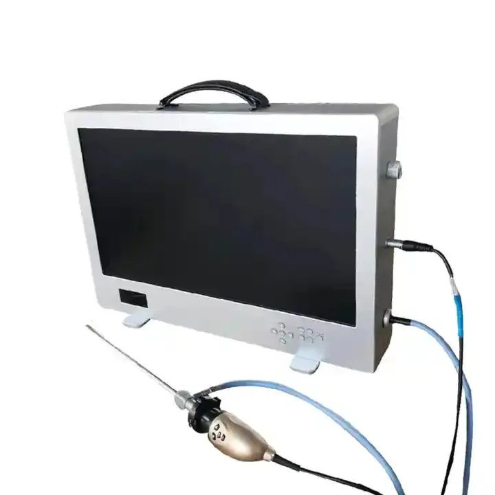 Digital Colposcope 1