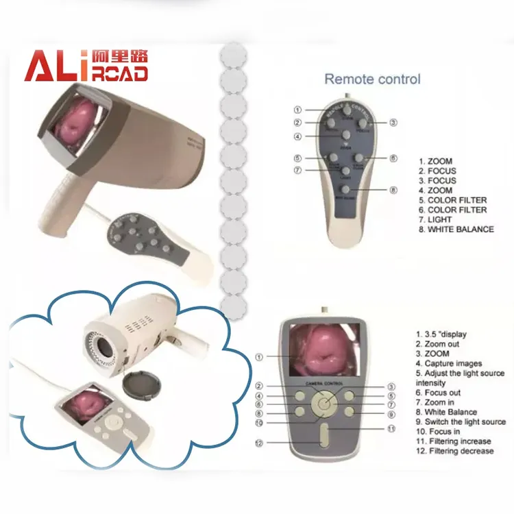 Colposcope Advantages