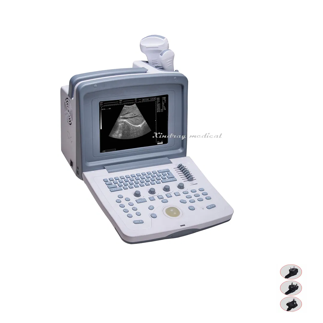 Medical Vet B-Ultrasound Diagnostic Apparatus Device