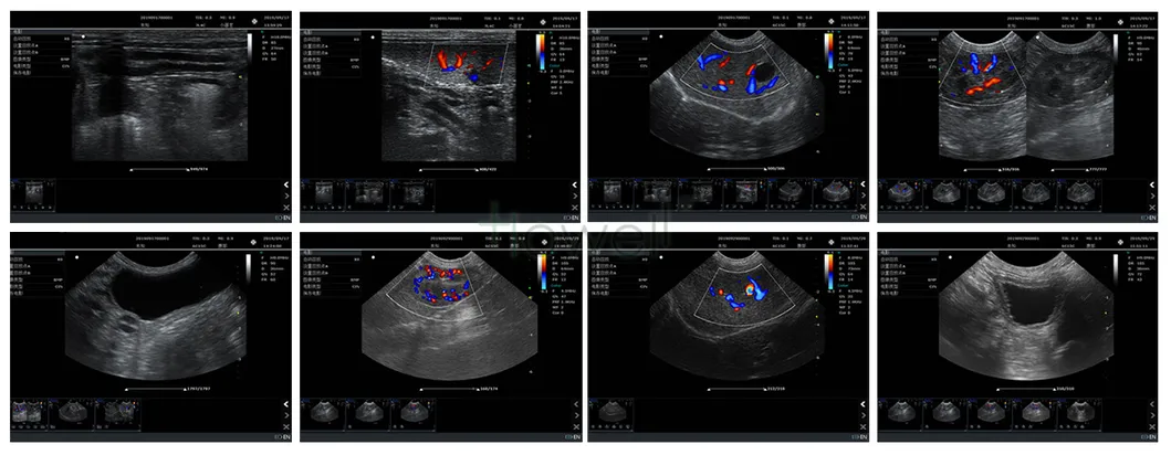 HE-S80 Ultrasound Device 2