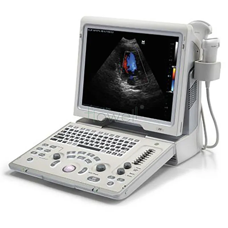 Digital Ultrasonic Diagnostic Imaging System 2