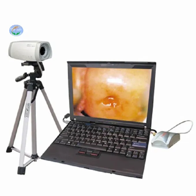 YJ-U150H Handheld Video Colposcope