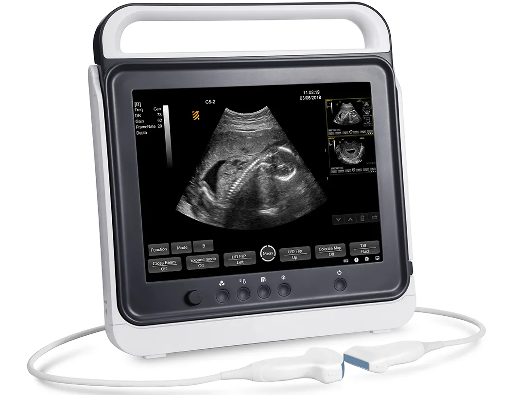 Portable Ultrasound Devices
