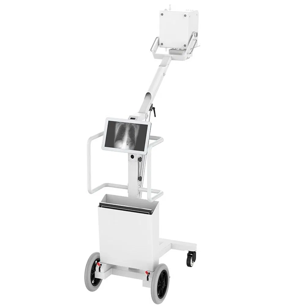 Human Portable Chest Xray Mobile Medical X-ray Equipments Dr Digital Portable X Ray Machine Price