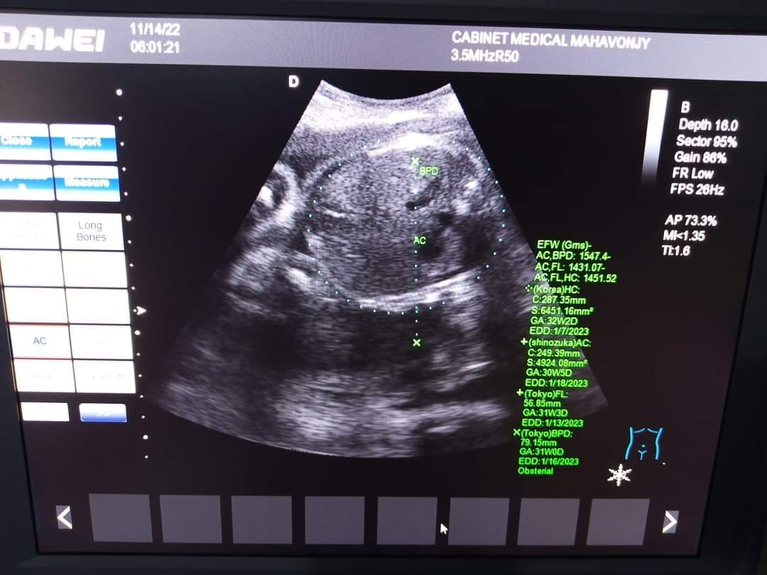 Laptop Ultrasound Device for Hospital 2023 New Arrival