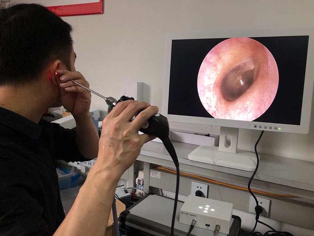 IN-HD7020 Surgical Hospital Medical Endoscopy Full Hd Digital Ent Endoscope Camera Ready To Ship All-in-one Endoscope Camera System