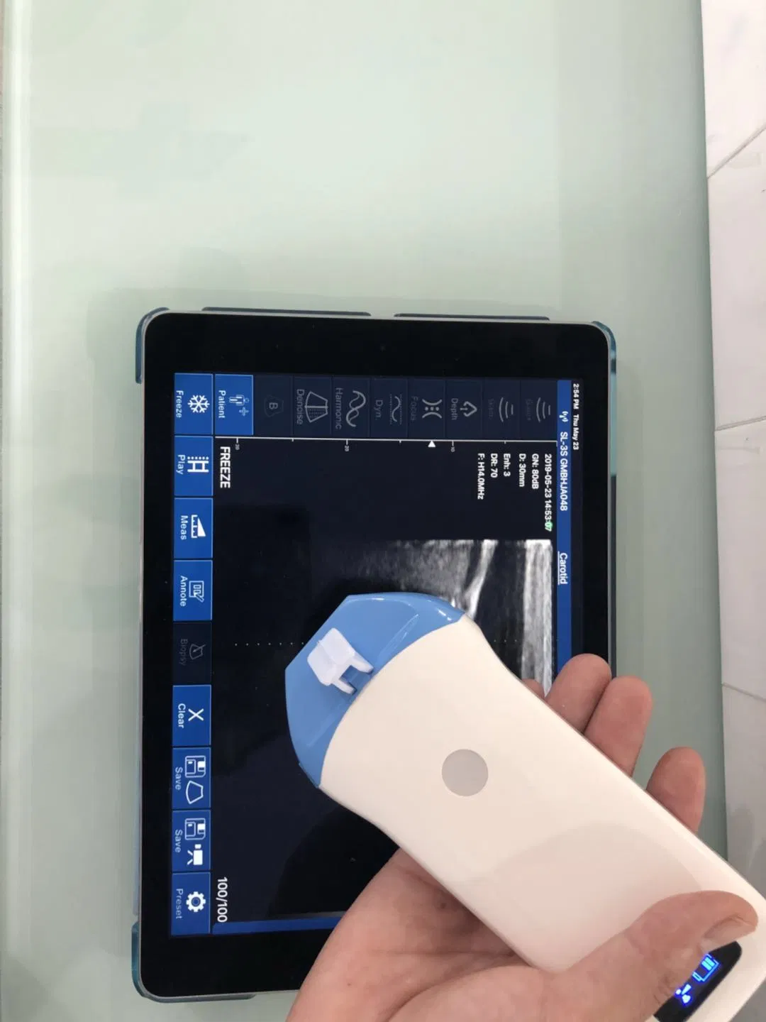 Portable Wireless Ultrasound Scanner Conevx Probe 3.5MHz Innovative Medical Device