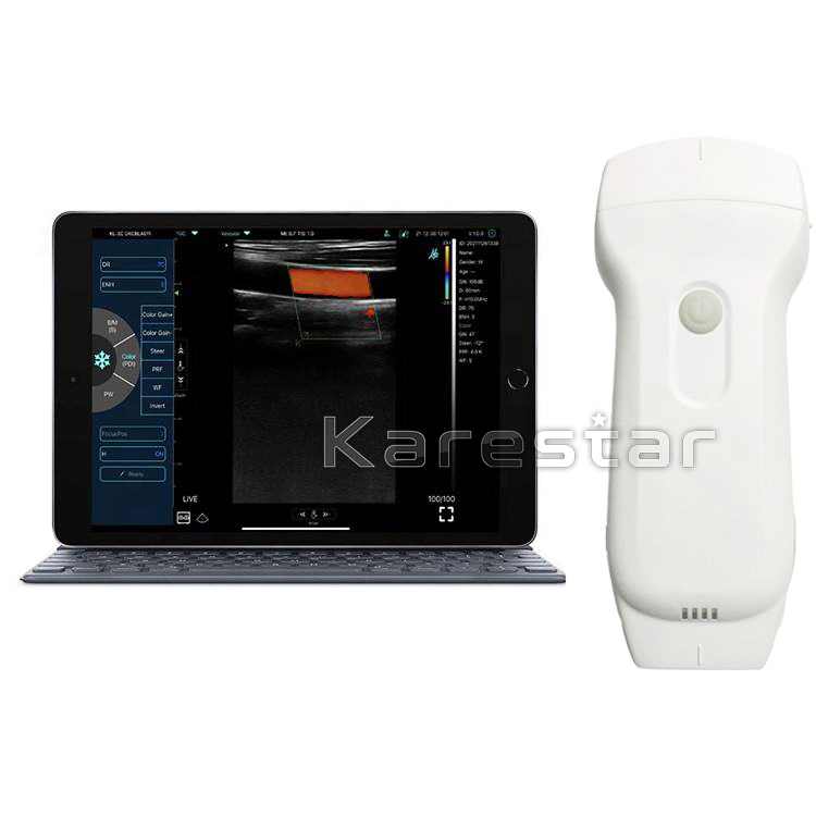 3 in 1 Color Doppler Wireless Probe WiFi and USB Ultrasound Device