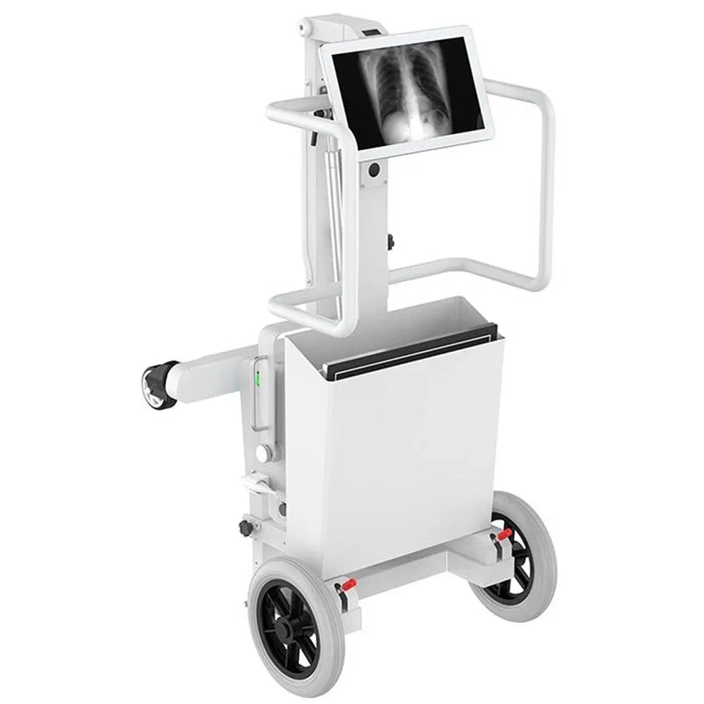 Human Portable Chest Xray Mobile Medical X-ray Equipments Dr Digital Portable X Ray Machine Price