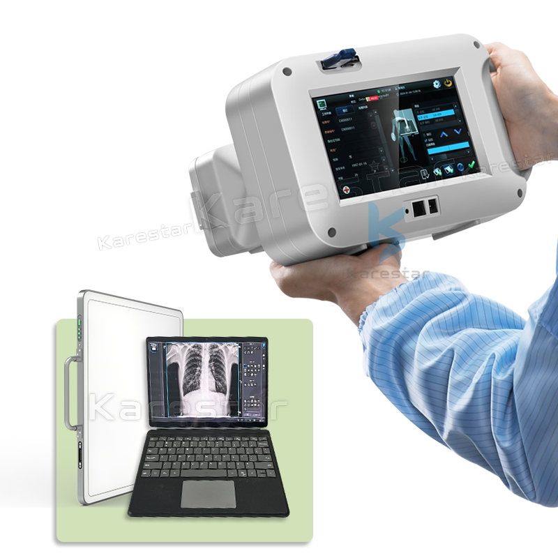 K-Dx70 Portable Medical X Ray Digital Machine for Human Use Cheapest Hospital Clinic X Ray Machine Price