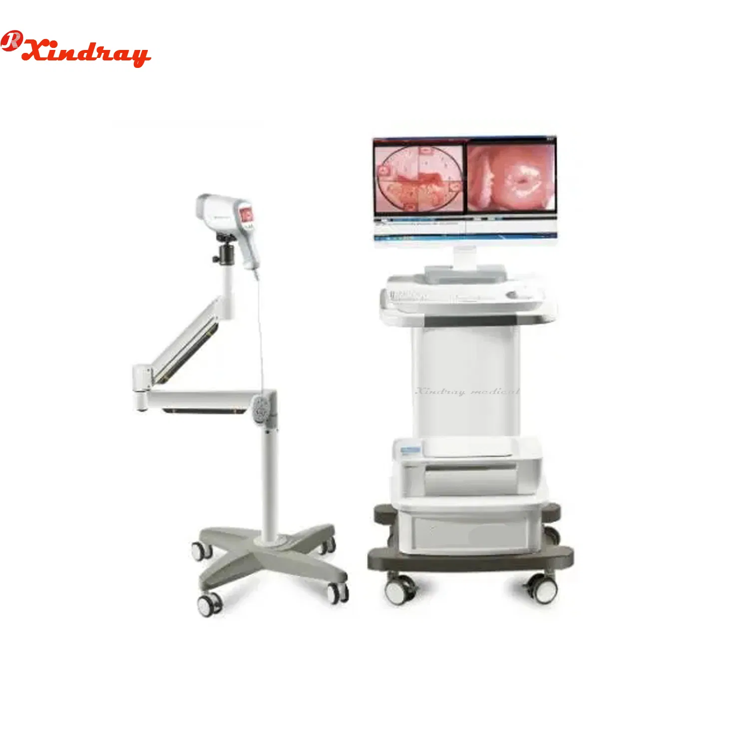 for Cervical Cancer and Cervical Screening Digital Gynecology Video Colposcope