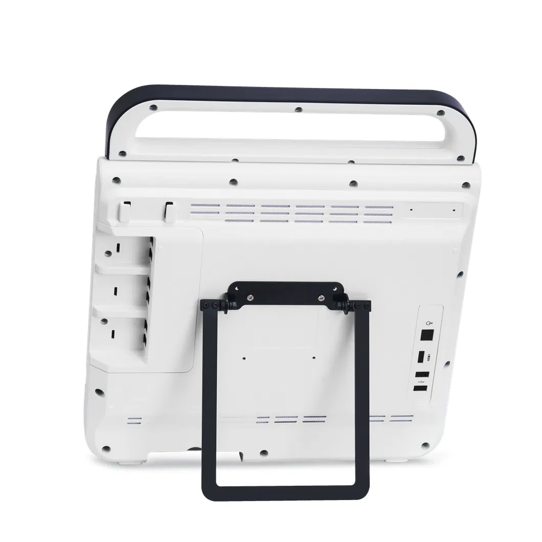 Hospital Clinic Touch Screen B/W Portable Ultrasound Devices