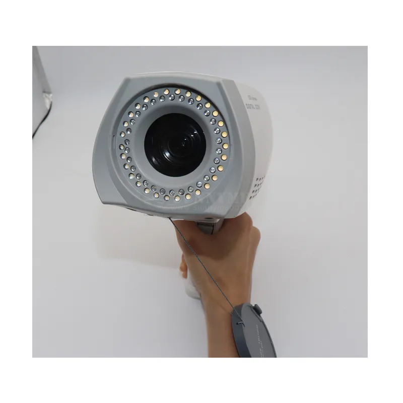 Digital Colposcope Detail 1