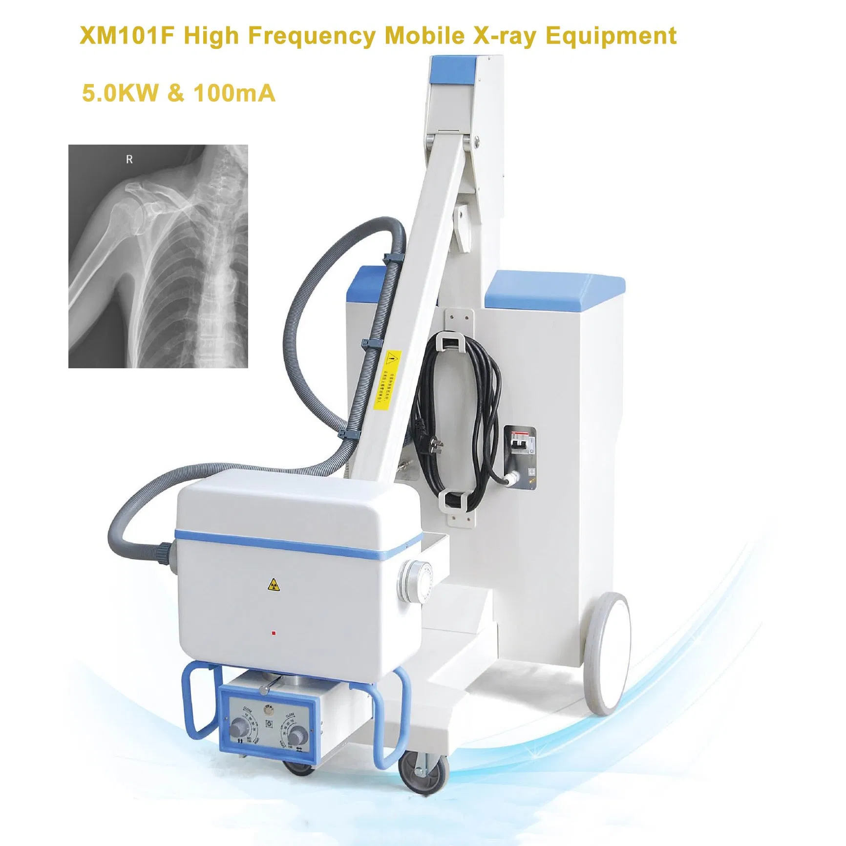 Manufacturer CE ISO Approved Xm101f Medical Digital Radiography 5kw 100mA High Frequency Mobile Imaging X Ray Unit X-ray Machine with 8 Inch Touch Screen