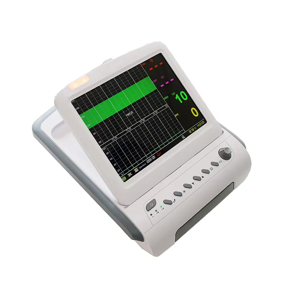 Fetal Monitor View 2