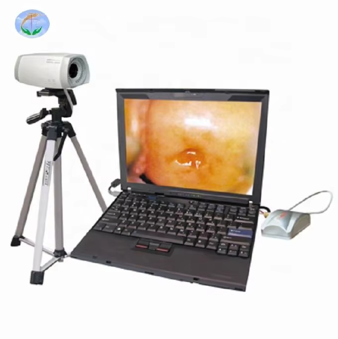 Portable Vagina Video Colposcope Notebook Digital Electronic Colposcope for Gynecology Colposcope Camera Machine