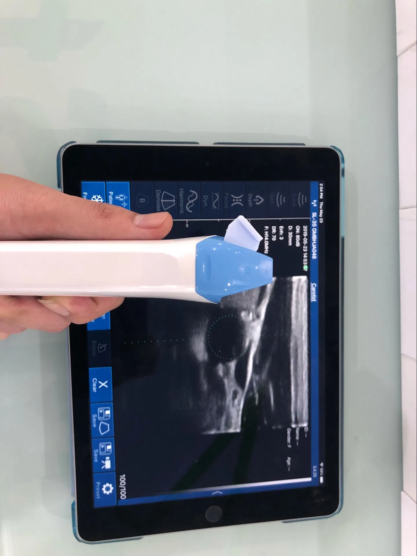 Portable Wireless Ultrasound Scanner Conevx Probe 3.5MHz Innovative Medical Device