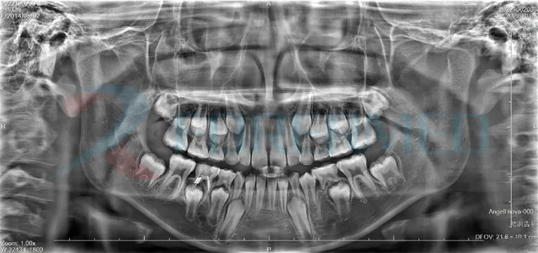Panoramic Algorithm 1