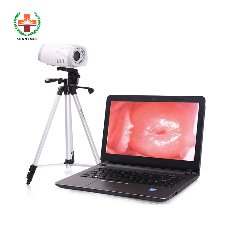 Sy-F003 Colposcope Digital Imaging System Gynecology Colposcope