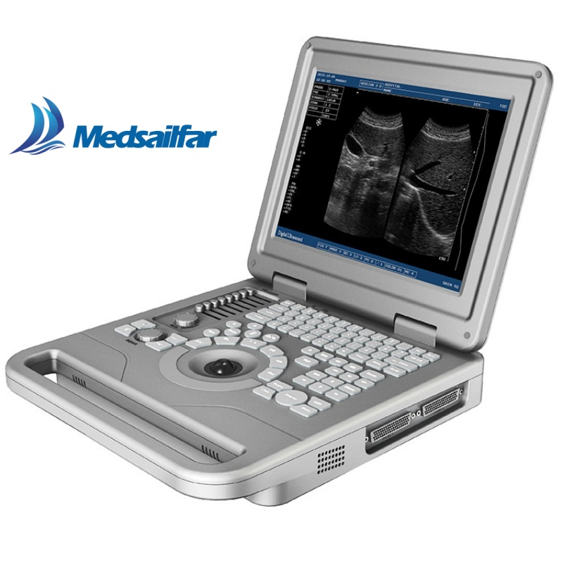 Comprehensive Patient Care Ecografo Detecting B/W Color Doppler Ultrasound Equipment Device