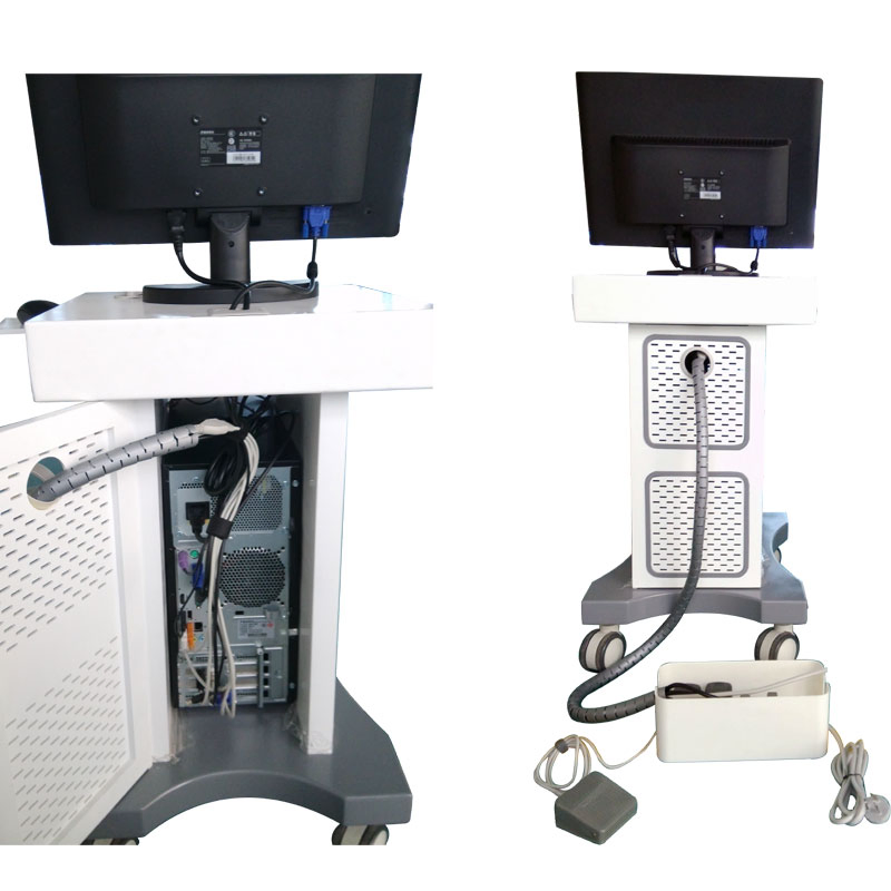 Medical Imaging Equipment Digital Colposcopes Gynecologic Examination for Vaginal Diagnosis