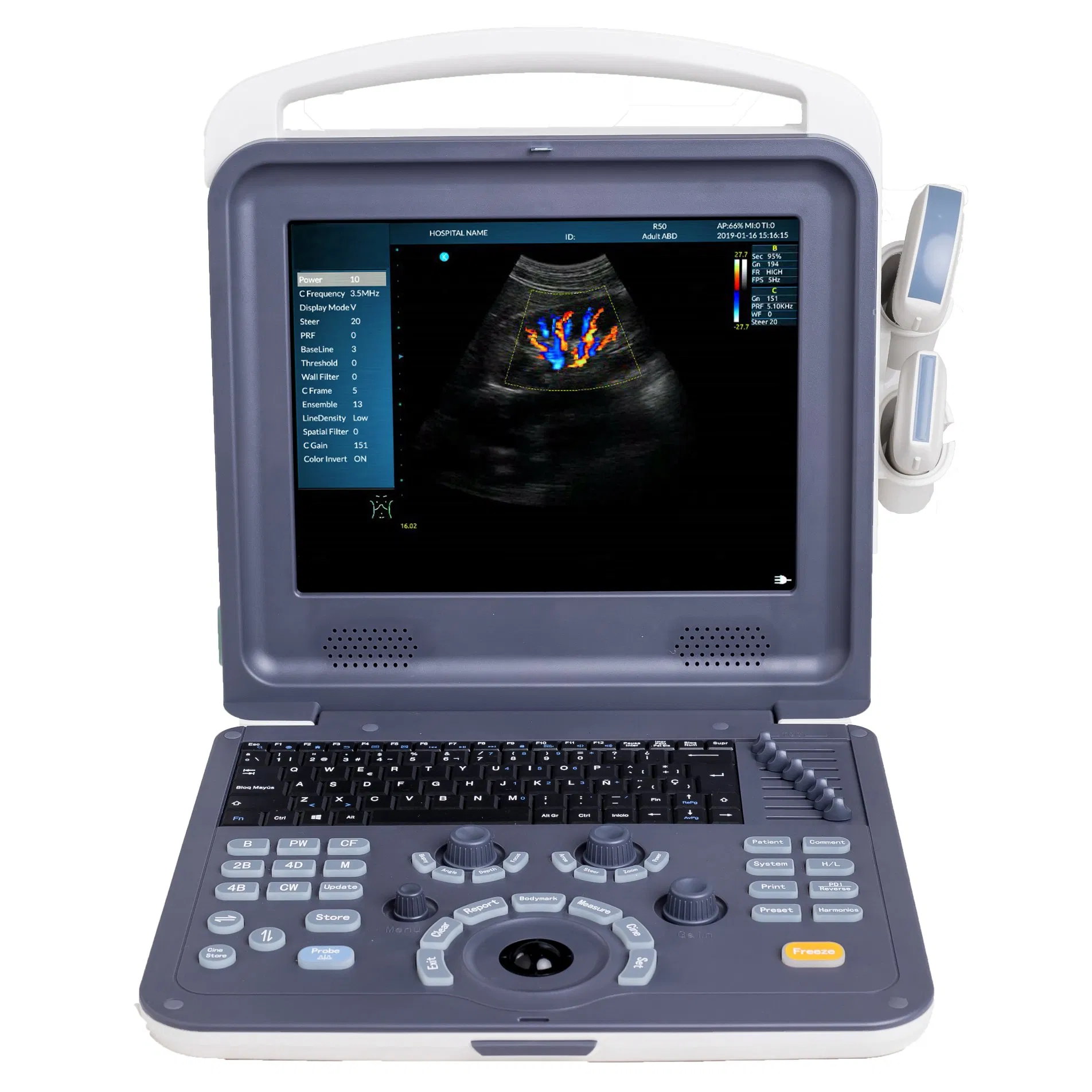 Umy Umus094 Advanced Color Doppler Ultrasonic Diagnostic Imaging System for Professionals