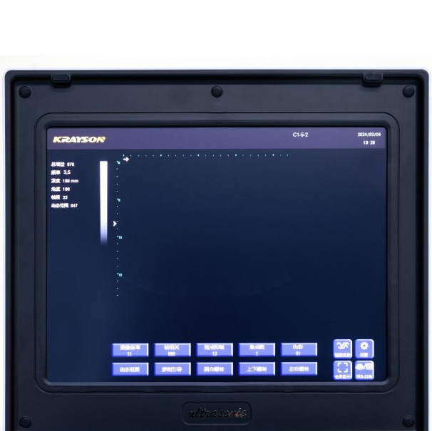 Portable Ultrasound Imaging Device with High Resolution HD Screen