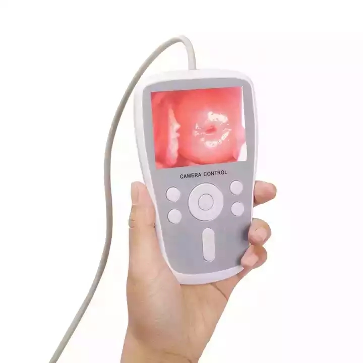 Hot Sale Medical Portable Camera Endoscope Digital Video Colposcope for Vagina