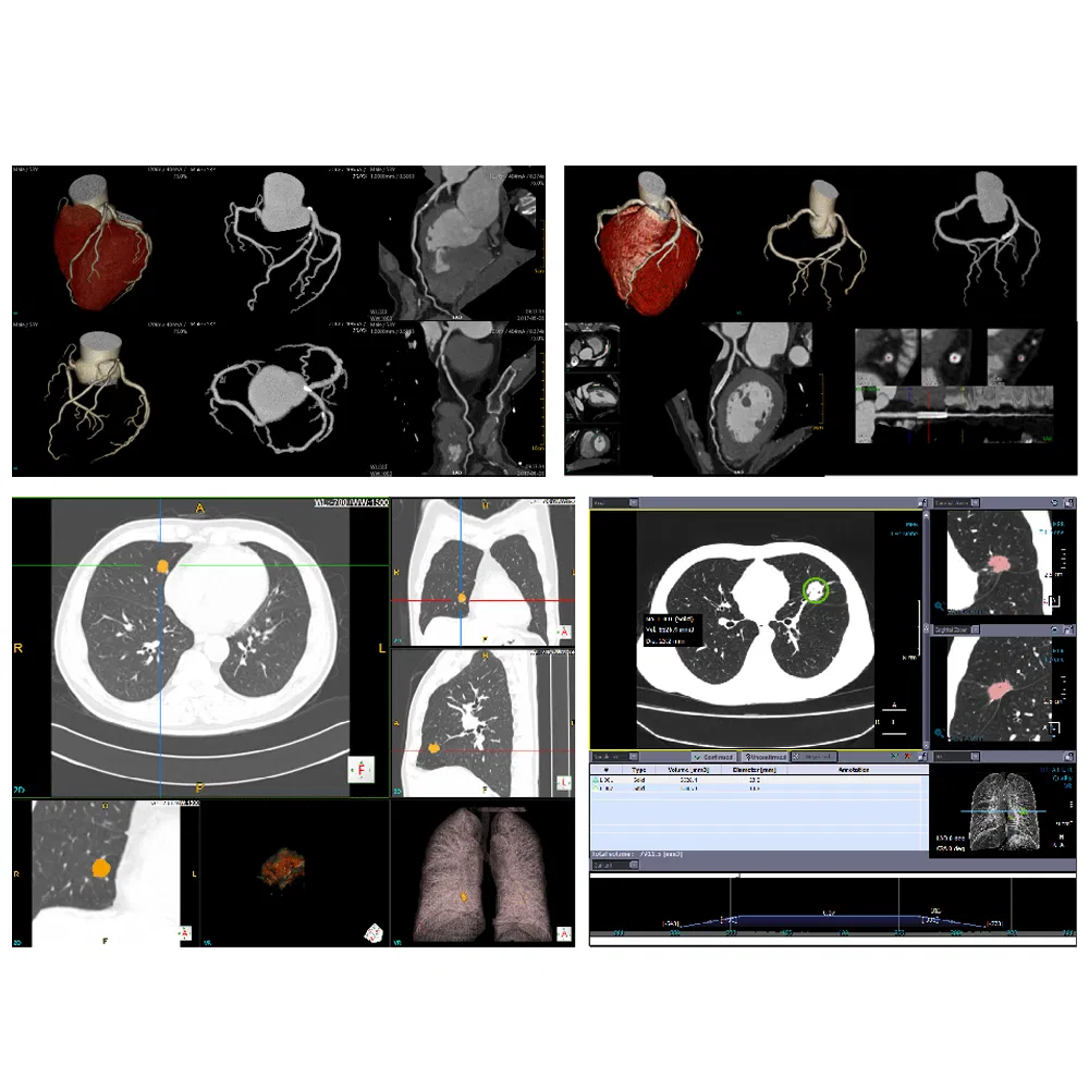 My-D055-2 Advance MRI CT Scanner with 64slice Machine Scanner
