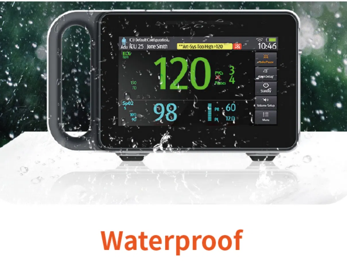 Portable Vital Signs Monitor 6 Parameters Type Animal Vet Multi Parameter Patient Monitor Transit Monitor