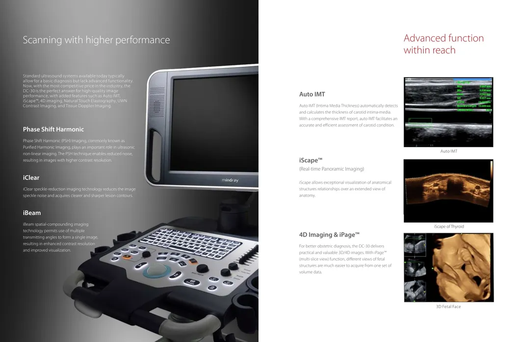 Mindray DC30 Imaging System 2