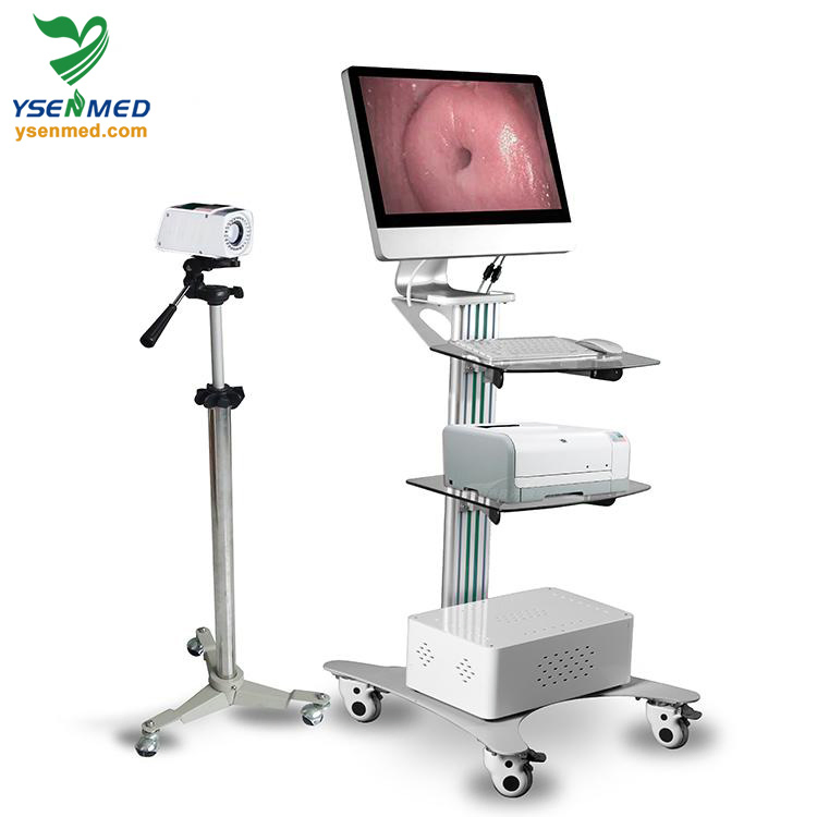 Ysenmed Medical Equipment Yssw3303A Digital Optical Colposcope
