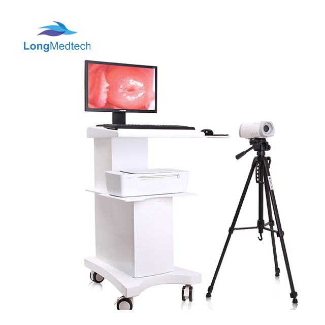 Medical Trolley Electronic Mobile Digital Video Colposcope for Vagina Gynecology