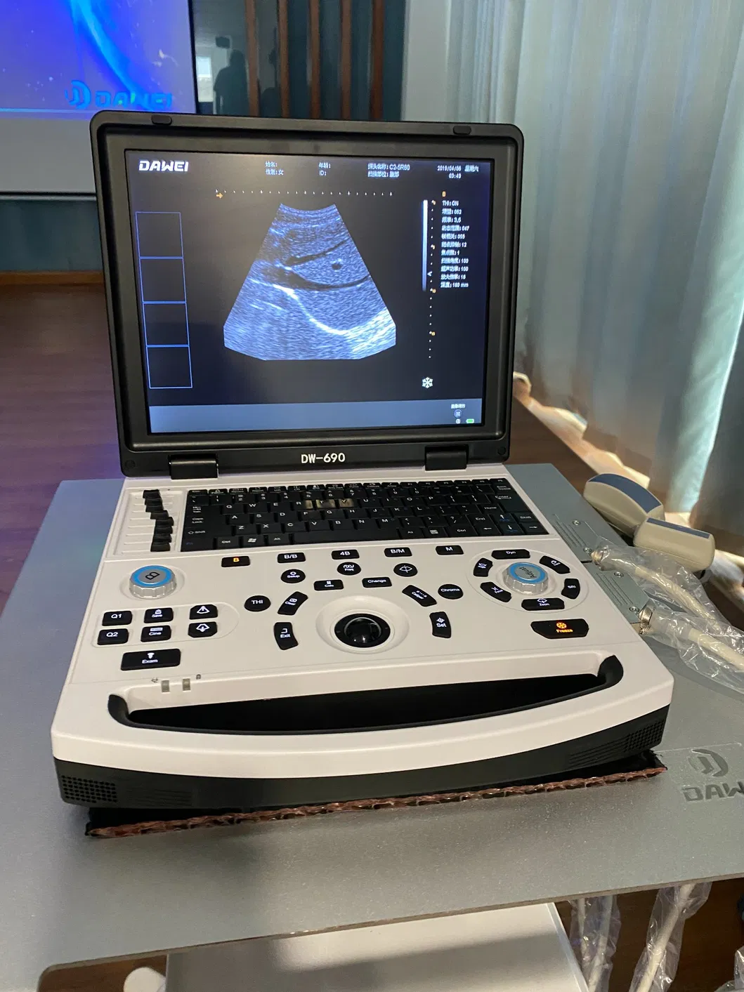 Ultrasound Detail View