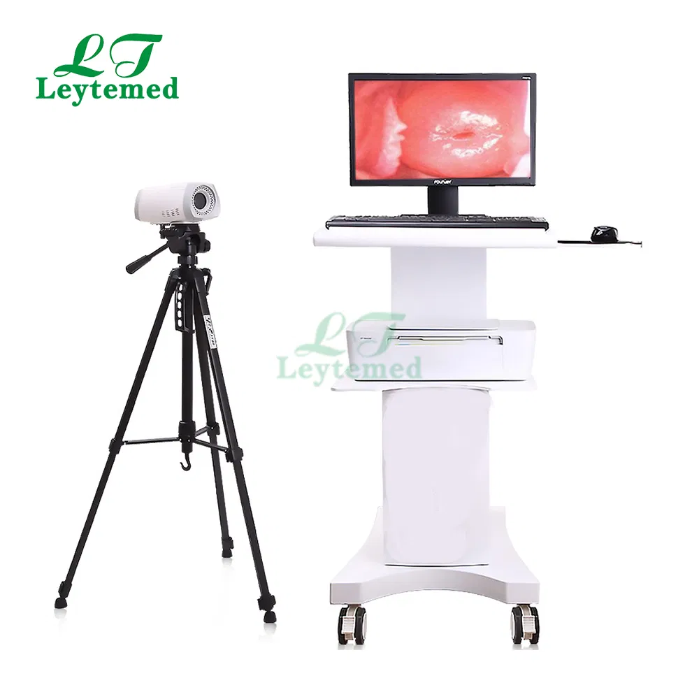 Trolley Video Colposcope