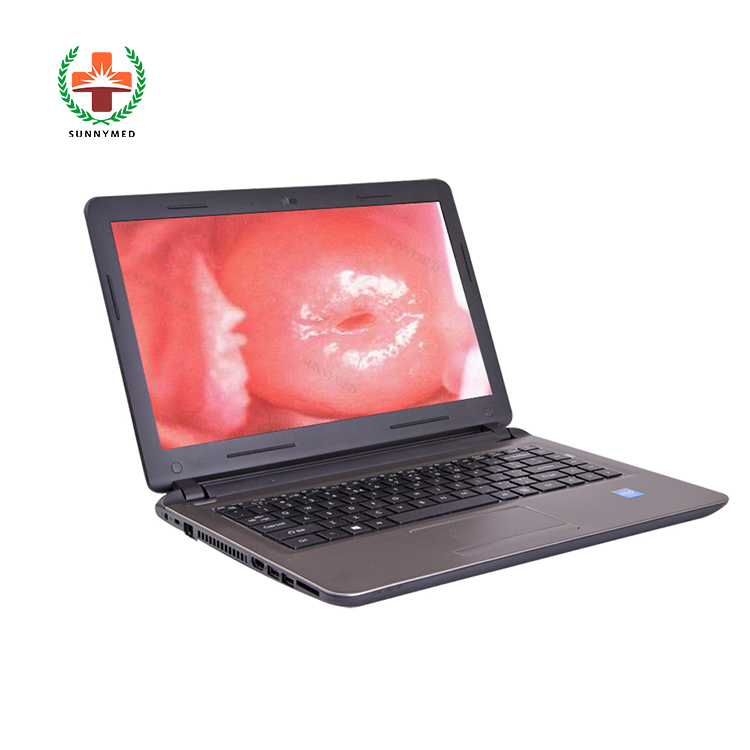 Sy-F003 Colposcope Digital Imaging System Gynecology Colposcope