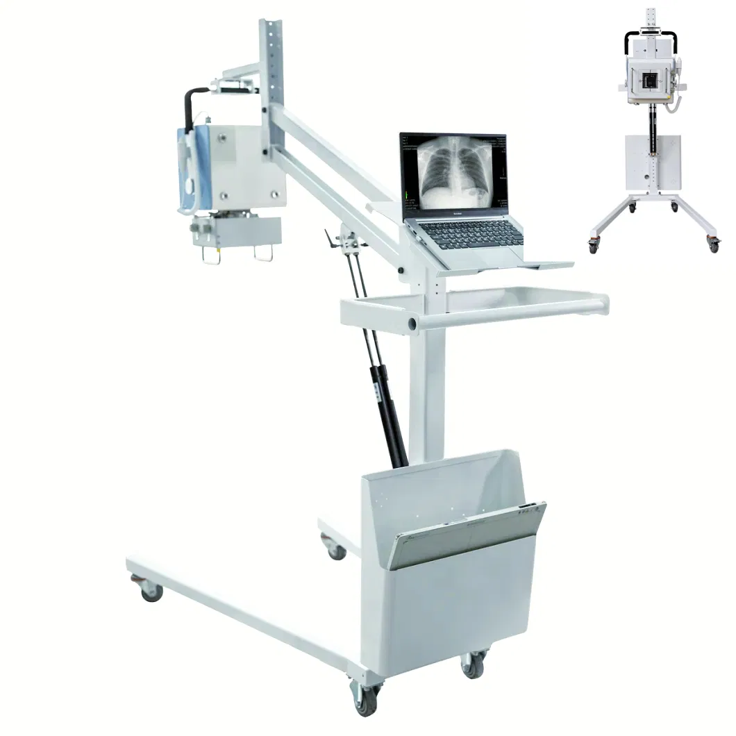 Mobile Radiographic Machine View 5