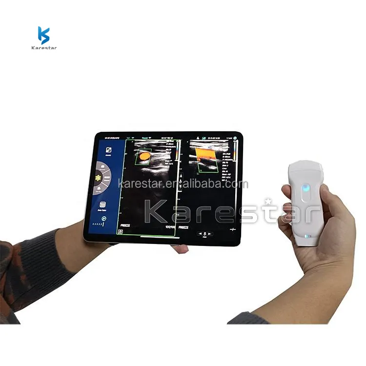 Wireless Handheld Ultrasound