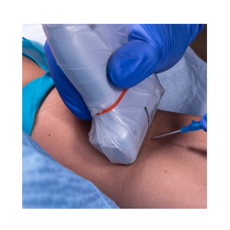 Factory Price Sterile Disposable Ultrasound Probe Cover Equipment Protective