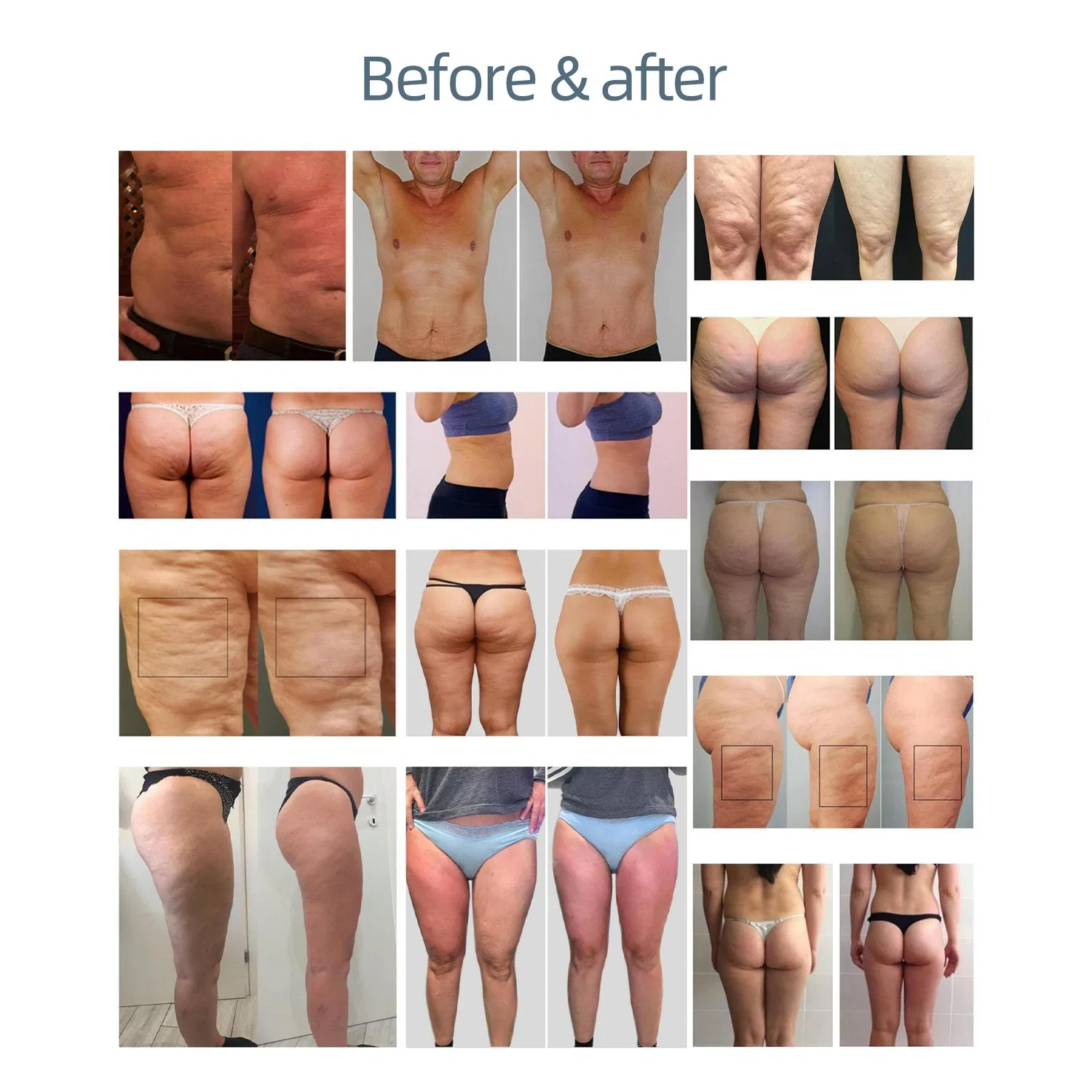 Professional Roller + Shockwave Therapy Machine - Deep Heat Massage and Chronic Pain Management