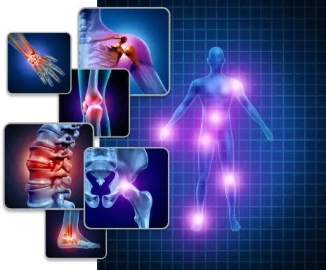 Application Illustration