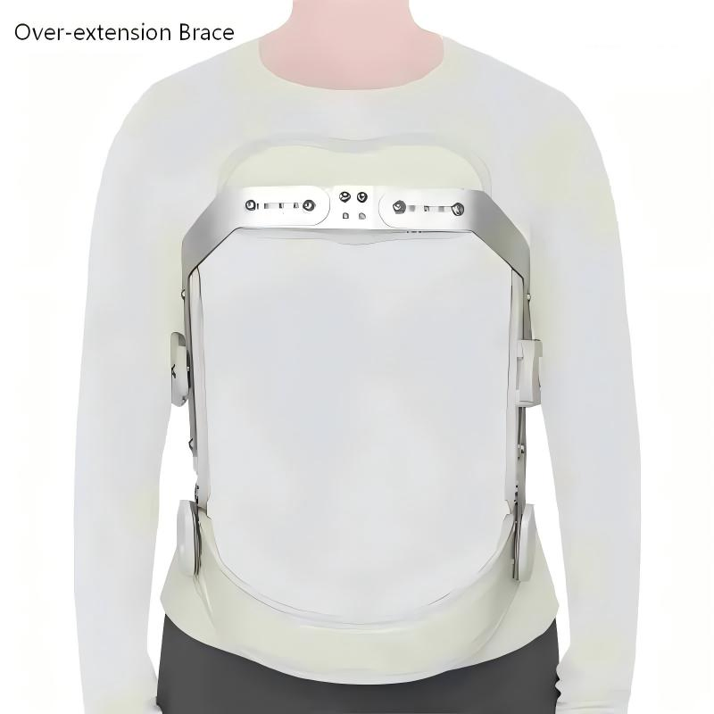 Adjustable Heat-Moldable Hyperextension Orthosis Over-Extension Fixator