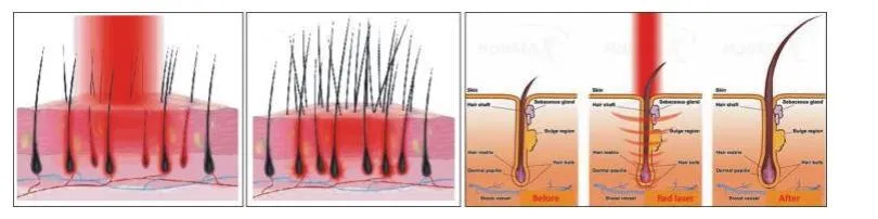 Mechanism of Action