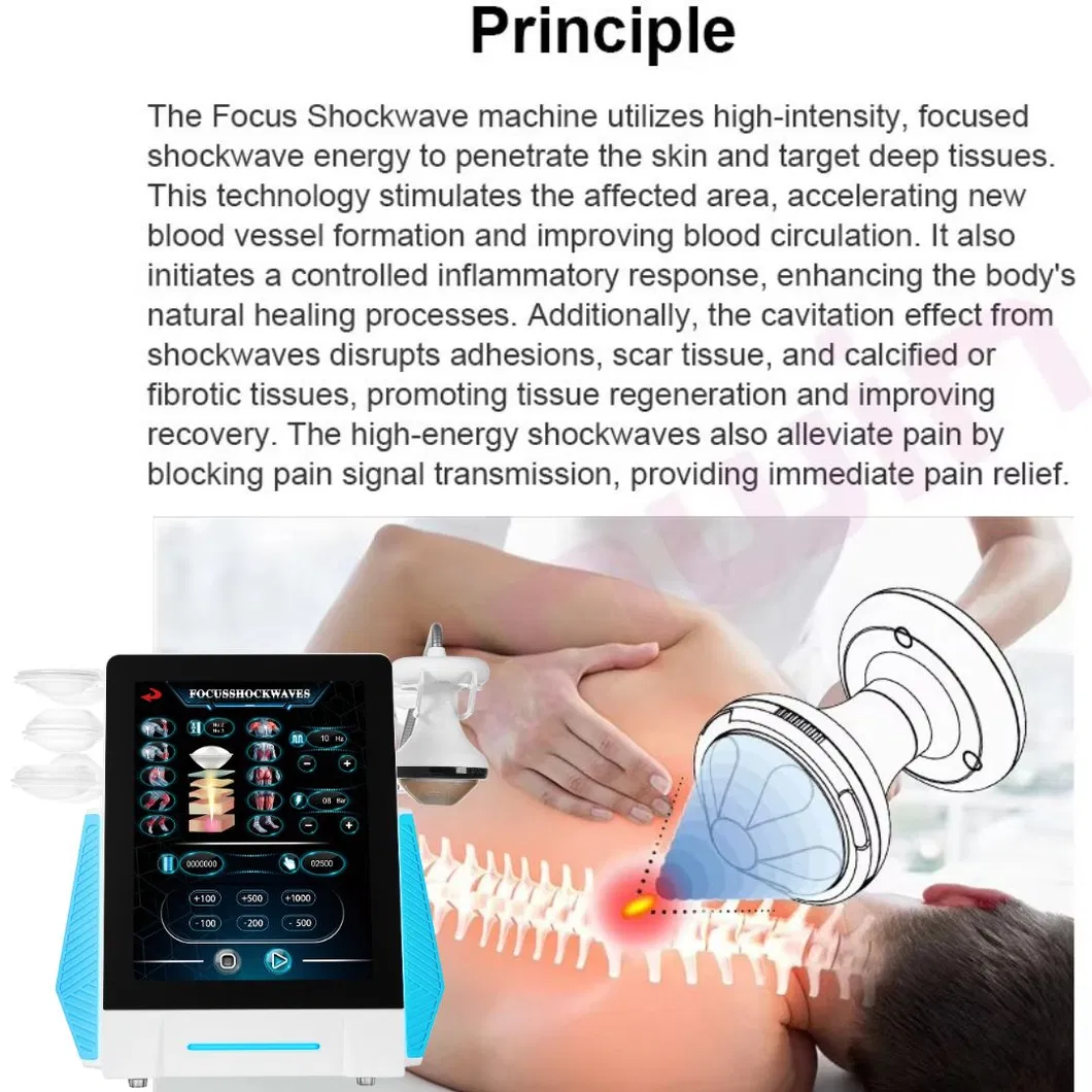 Focus Shockwave Technology