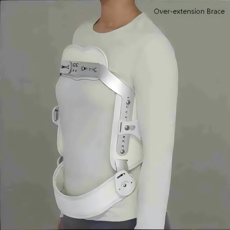 Over-Extension Lightweight Hyperextension Heat-Moldable Hyperextension Support